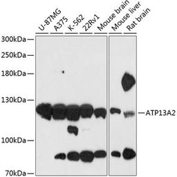 Western blot - ATP13A2 antibody (A13083)