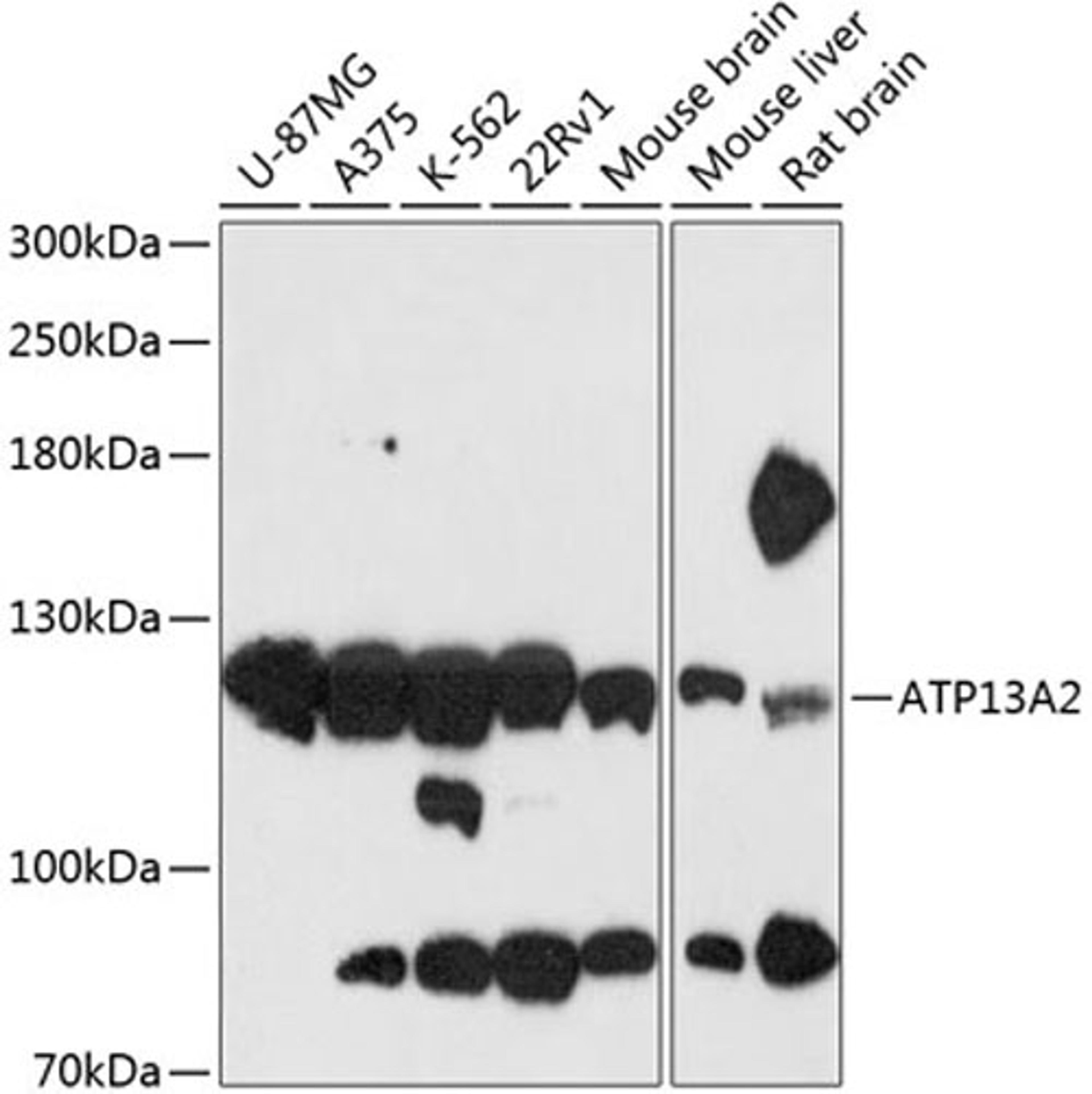 Western blot - ATP13A2 antibody (A13083)