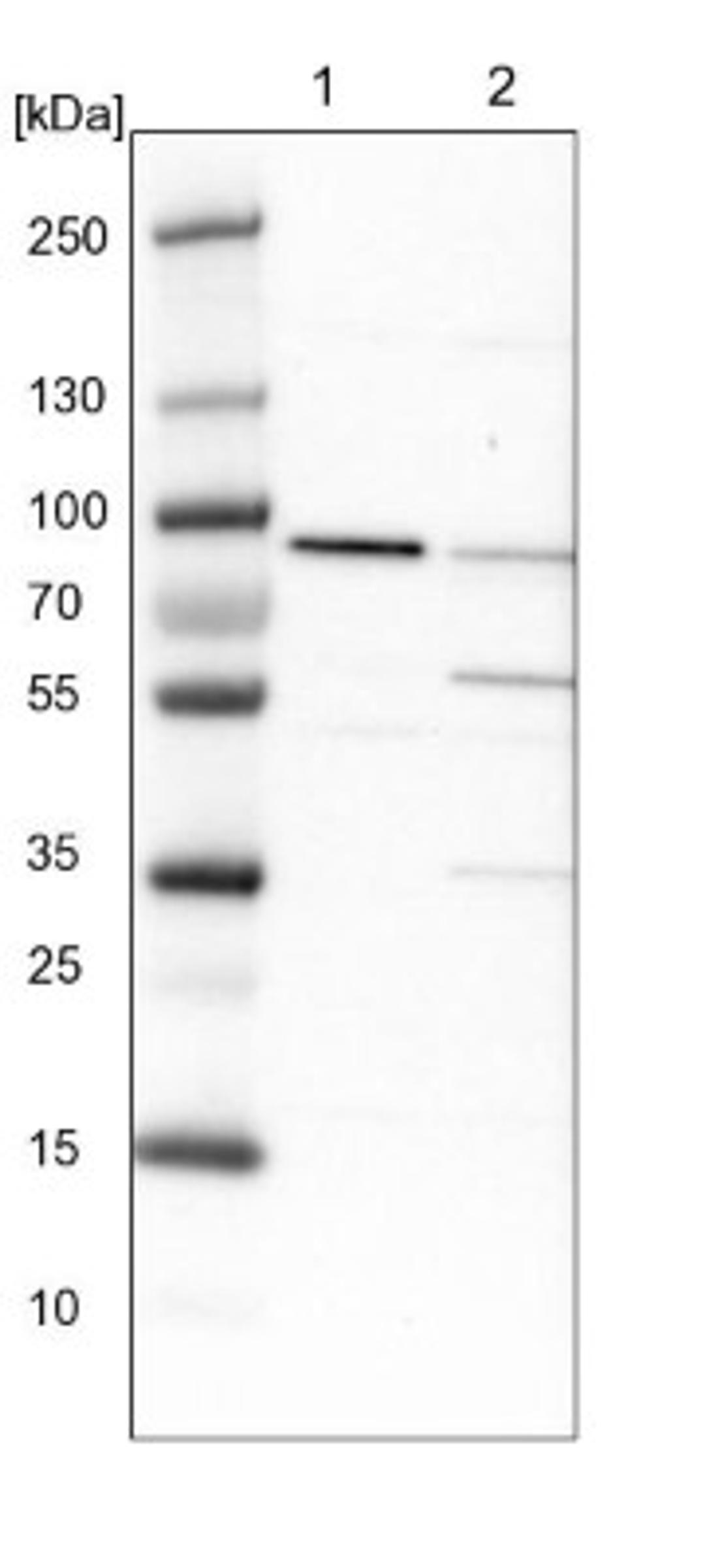 Western Blot: IFT81 Antibody [NBP1-84558] - Lane 1: NIH-3T3 cell lysate (Mouse embryonic fibroblast cells)<br/>Lane 2: NBT-II cell lysate (Rat Wistar bladder tumour cells)