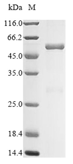 (Tris-Glycine gel) Discontinuous SDS-PAGE (reduced) with 5% enrichment gel and 15% separation gel.