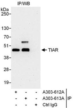 Detection of human TIAR by western blot of immunoprecipitates.