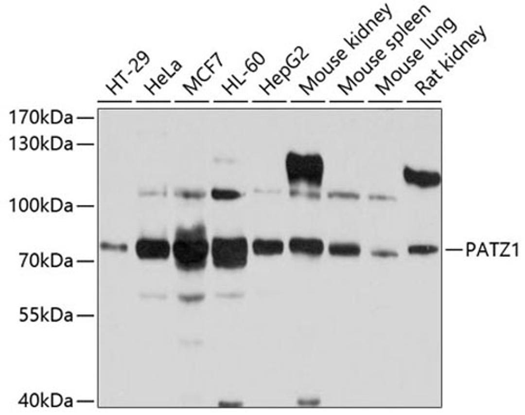 Western blot - PATZ1 antibody (A10053)