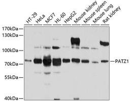 Western blot - PATZ1 antibody (A10053)