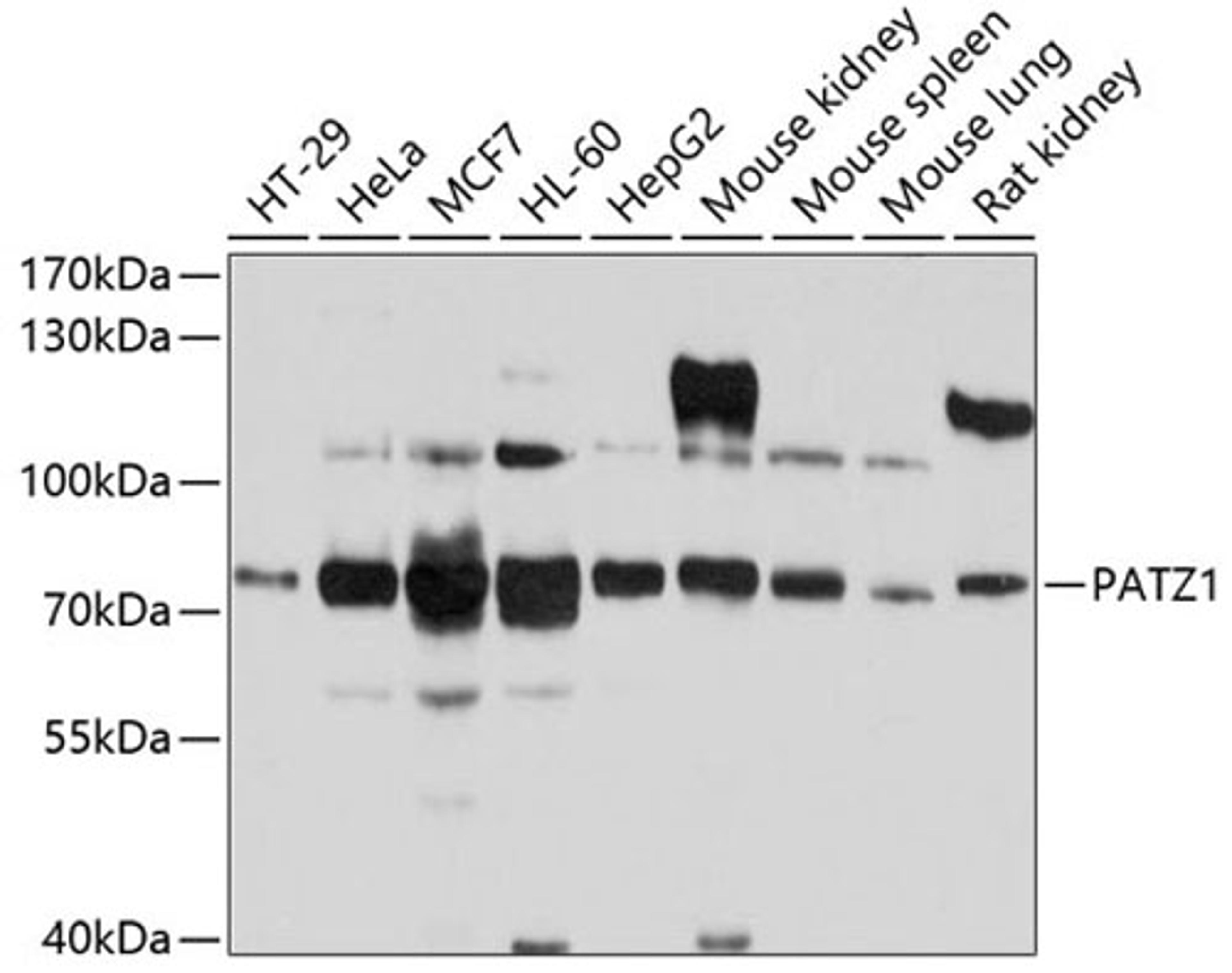 Western blot - PATZ1 antibody (A10053)