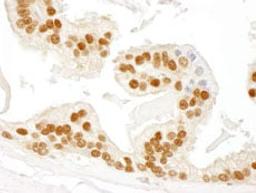 Detection of human RAD23B by immunohistochemistry.