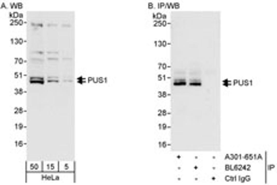 Detection of human PUS1 by western blot and immunoprecipitation.