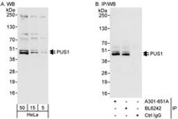 Detection of human PUS1 by western blot and immunoprecipitation.