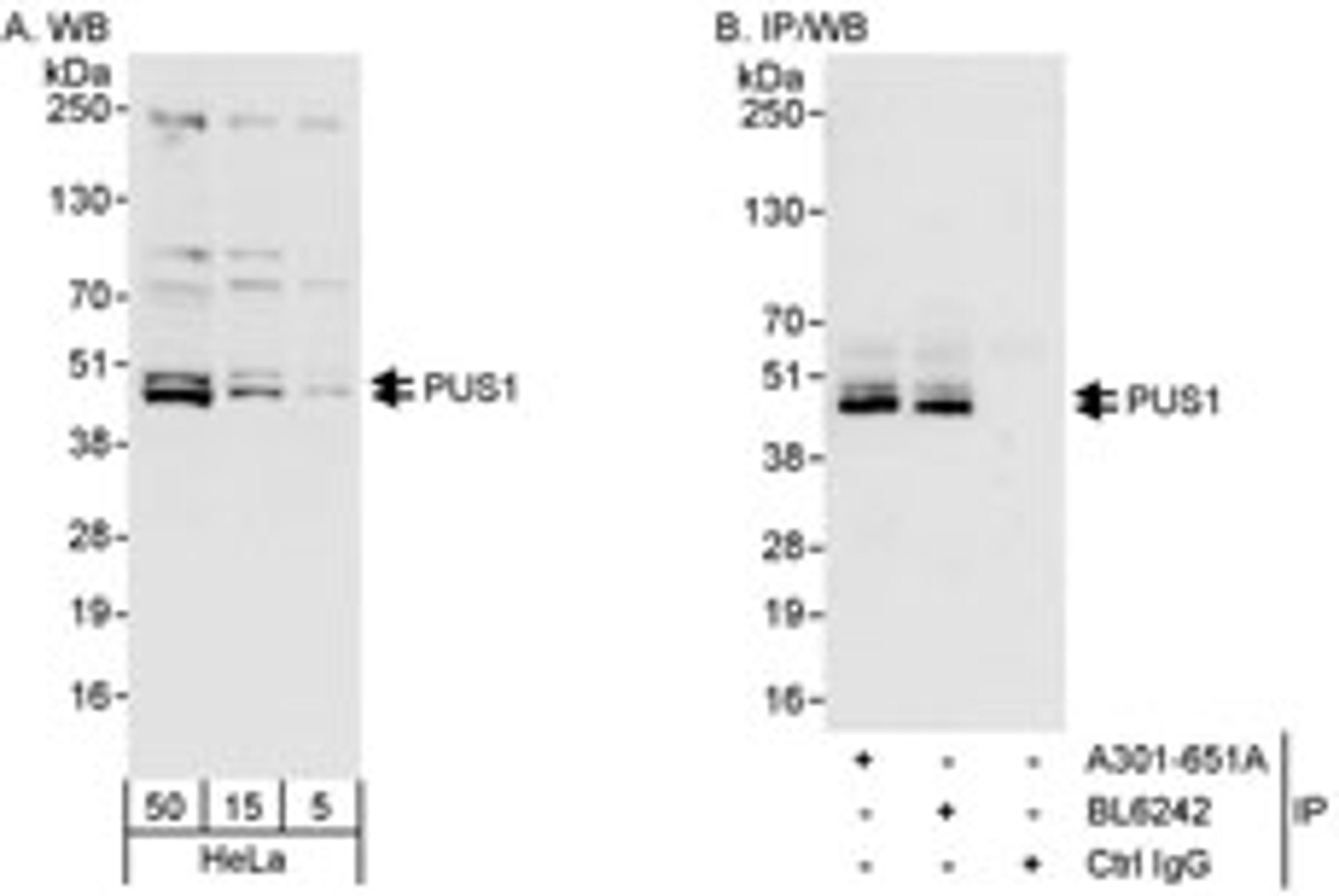 Detection of human PUS1 by western blot and immunoprecipitation.