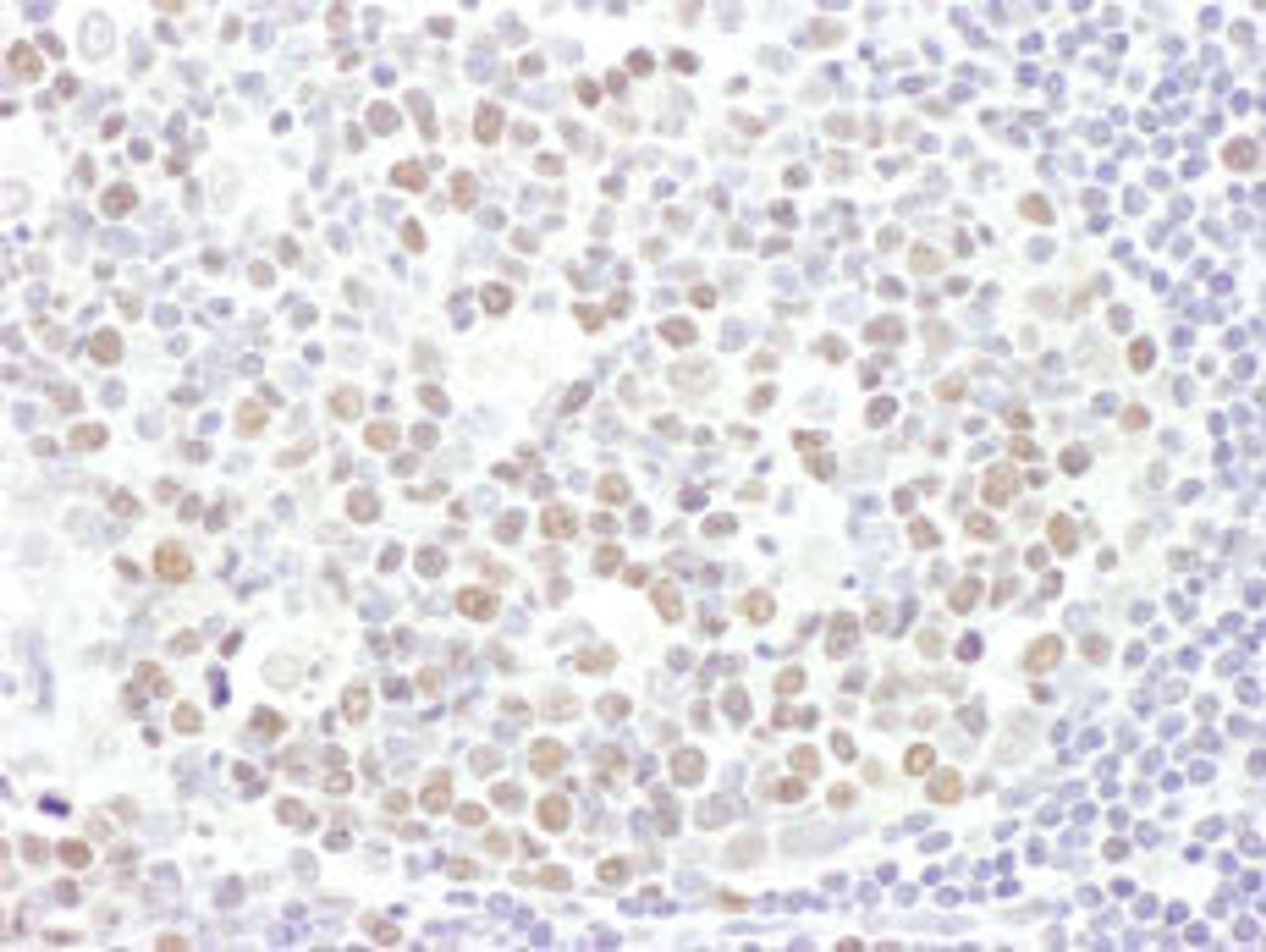 Detection of human EZH2 by immunohistochemistry.