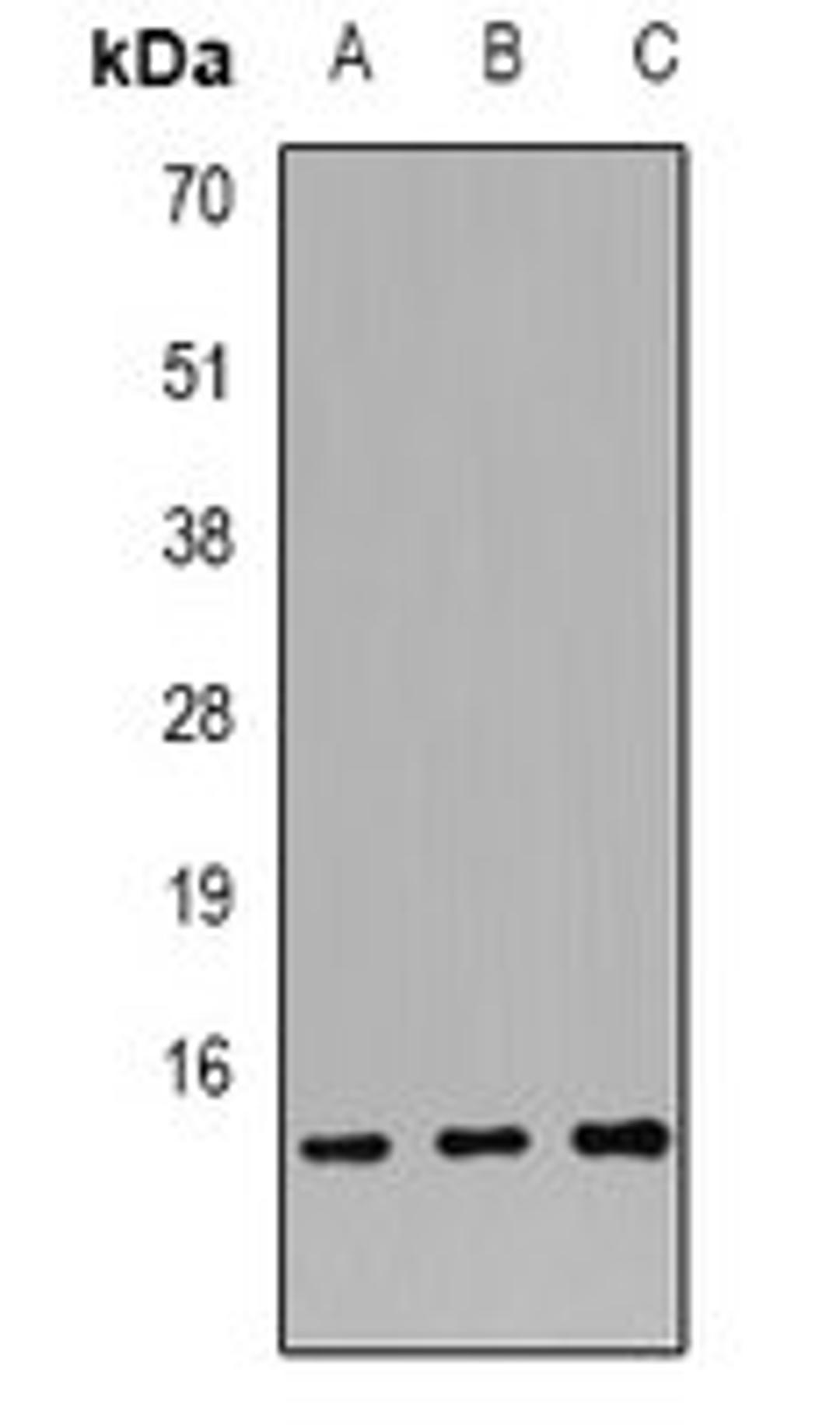 Western blot analysis of HL60 (Lane1), SW620 (Lane2), K562 (Lane3) whole cell lysates using S100A12 antibody