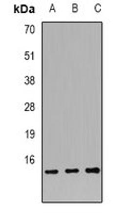 Western blot analysis of HL60 (Lane1), SW620 (Lane2), K562 (Lane3) whole cell lysates using S100A12 antibody