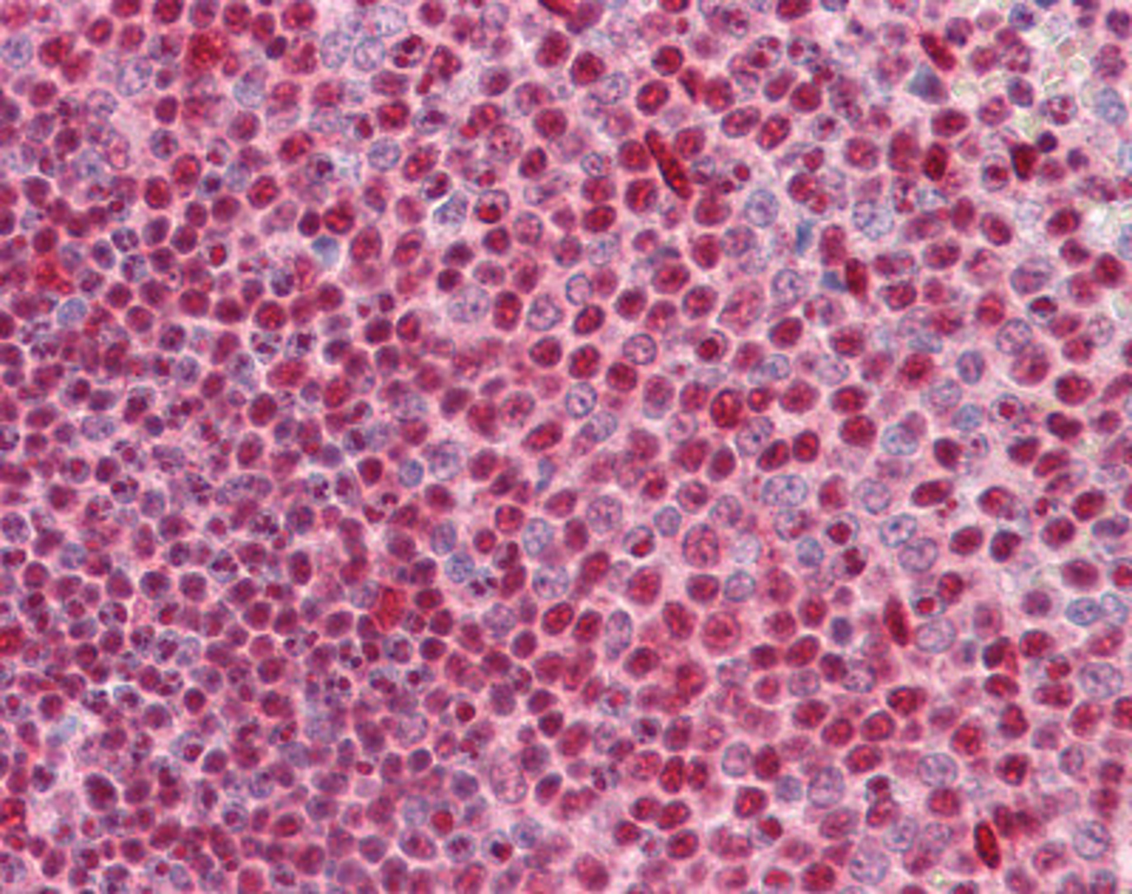 Immunohistochemistry of human spleen tissue stained using CUTL1 Monoclonal Antibody.