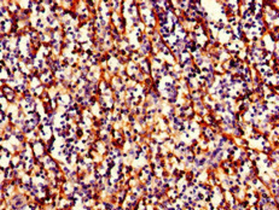Immunohistochemistry of paraffin-embedded human spleen tissue using CSB-PA15089D0Rb at dilution of 1:100