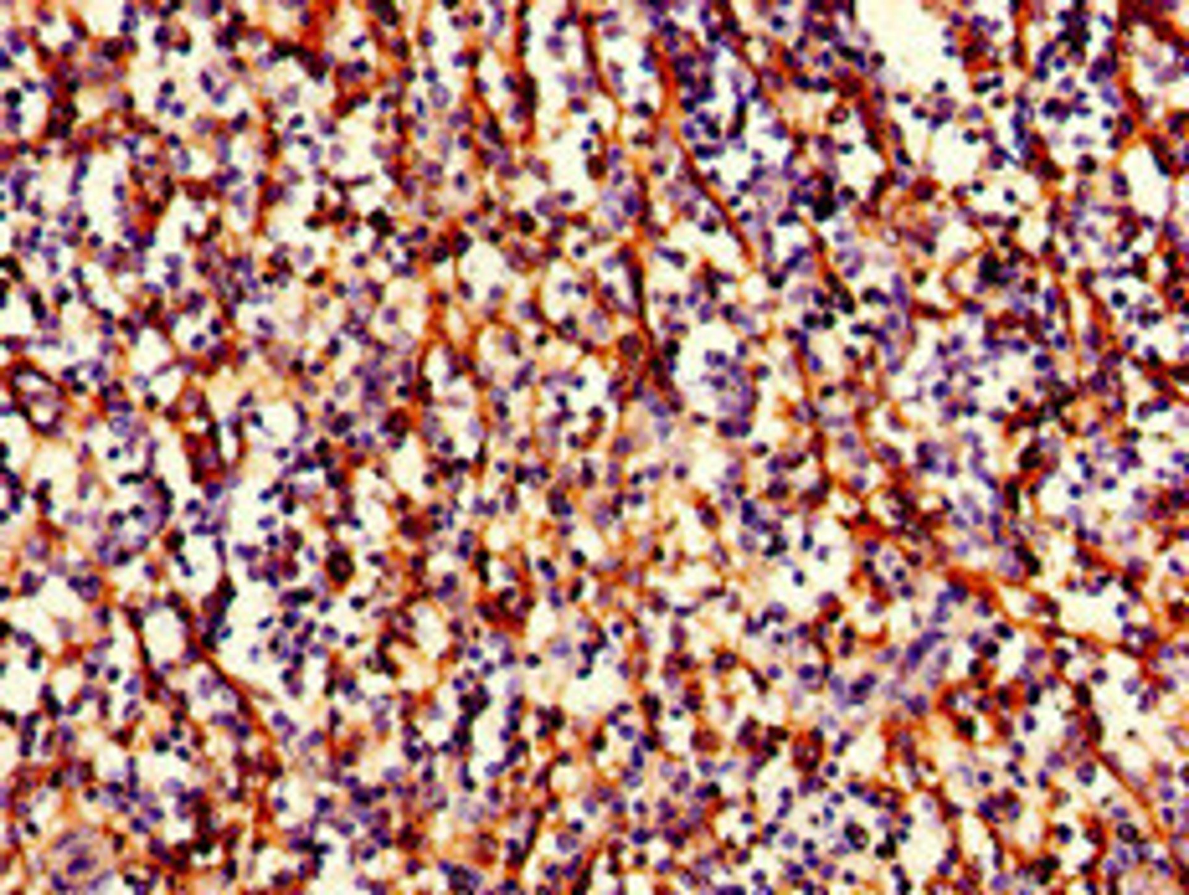 Immunohistochemistry of paraffin-embedded human spleen tissue using CSB-PA15089D0Rb at dilution of 1:100