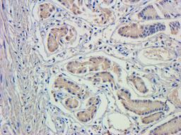 IHC-P staining of pig stomach tissue using anti-GCN2 (phospho-Thr898) (dilution at 1:200)