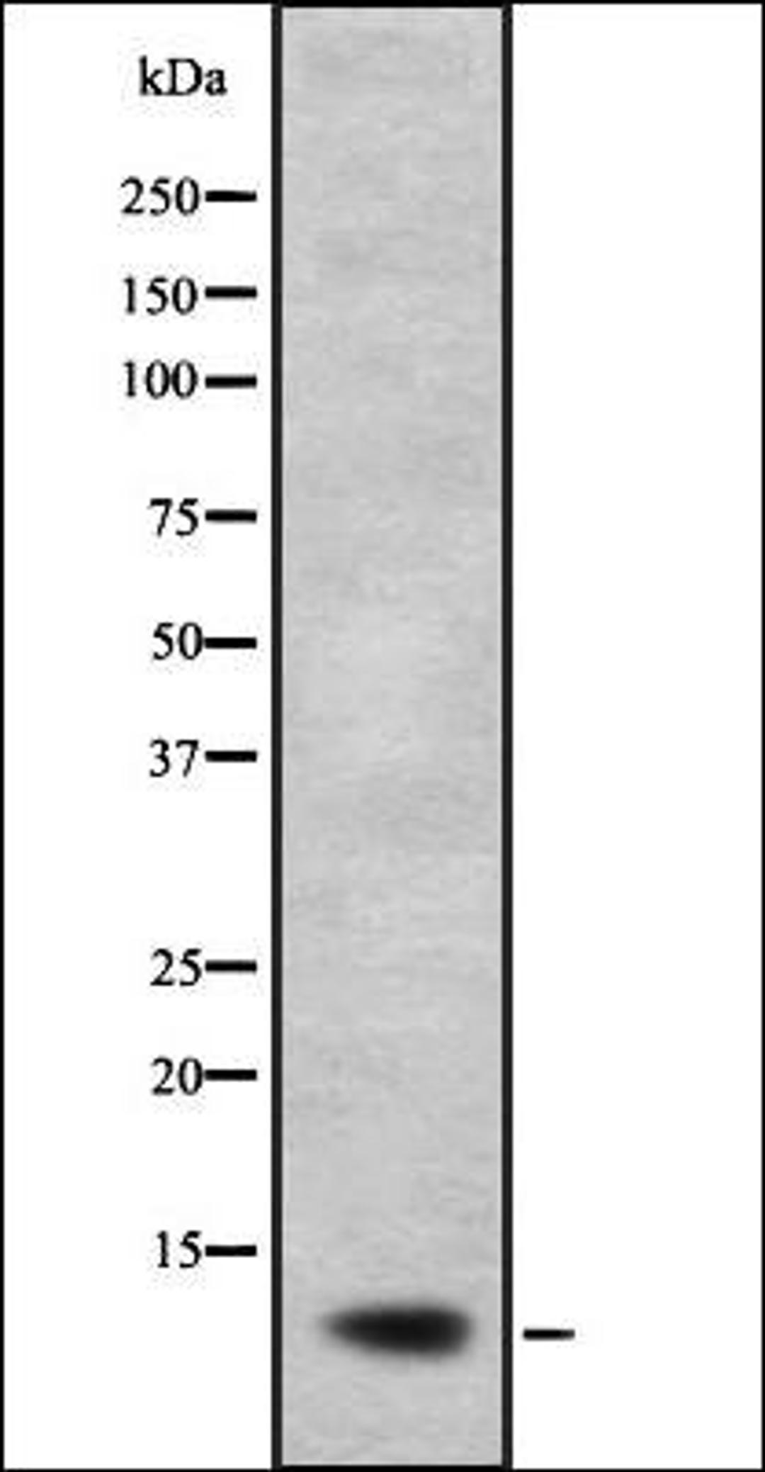 Western blot analysis of A673 lysate using NDUFB2 antibody