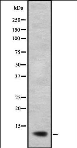 Western blot analysis of A673 lysate using NDUFB2 antibody