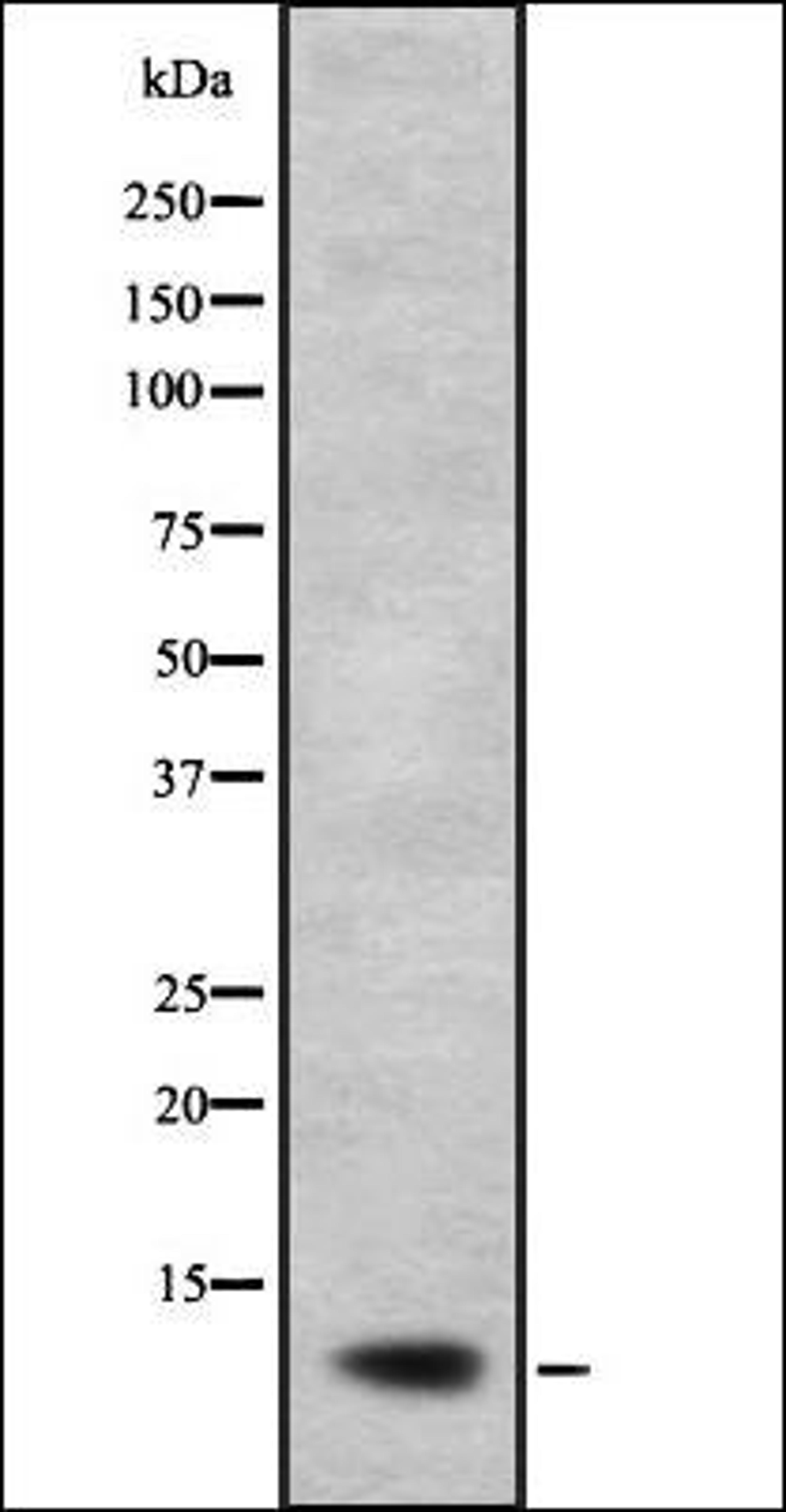 Western blot analysis of A673 lysate using NDUFB2 antibody