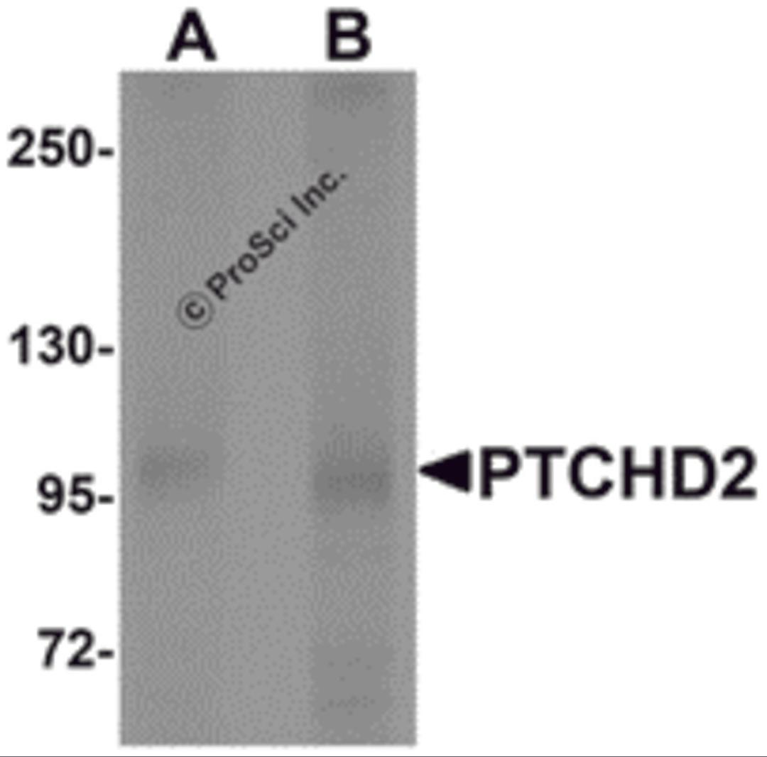 Western blot analysis of PTCHD2 in mouse kidney tissue lysate with PTCHD2 antibody at (A) 1 and (B) 2 &#956;g/mL.