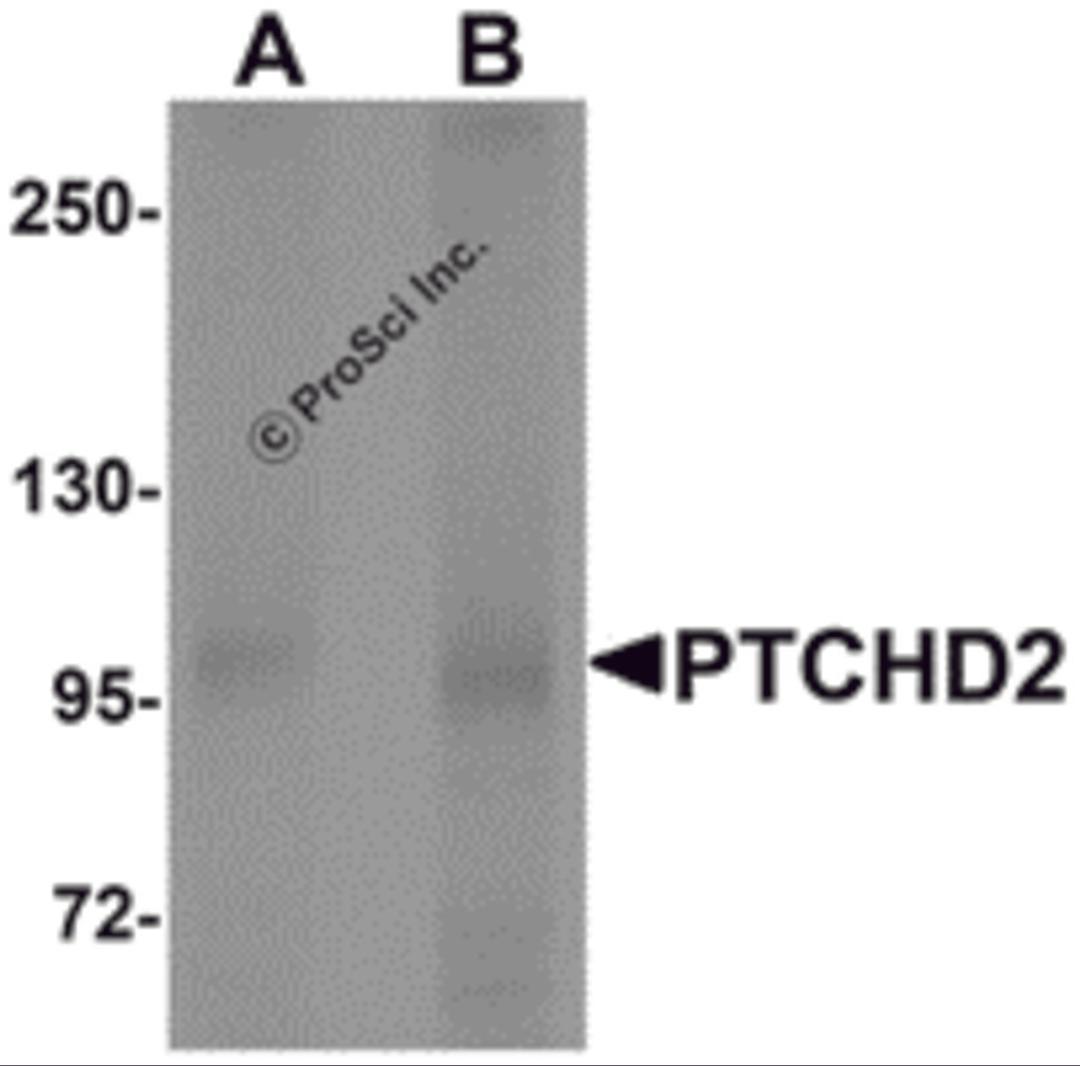 Western blot analysis of PTCHD2 in mouse kidney tissue lysate with PTCHD2 antibody at (A) 1 and (B) 2 μg/mL.