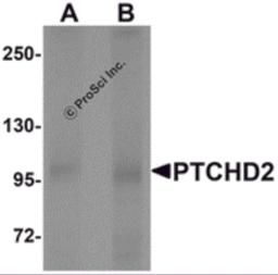 Western blot analysis of PTCHD2 in mouse kidney tissue lysate with PTCHD2 antibody at (A) 1 and (B) 2 μg/mL.