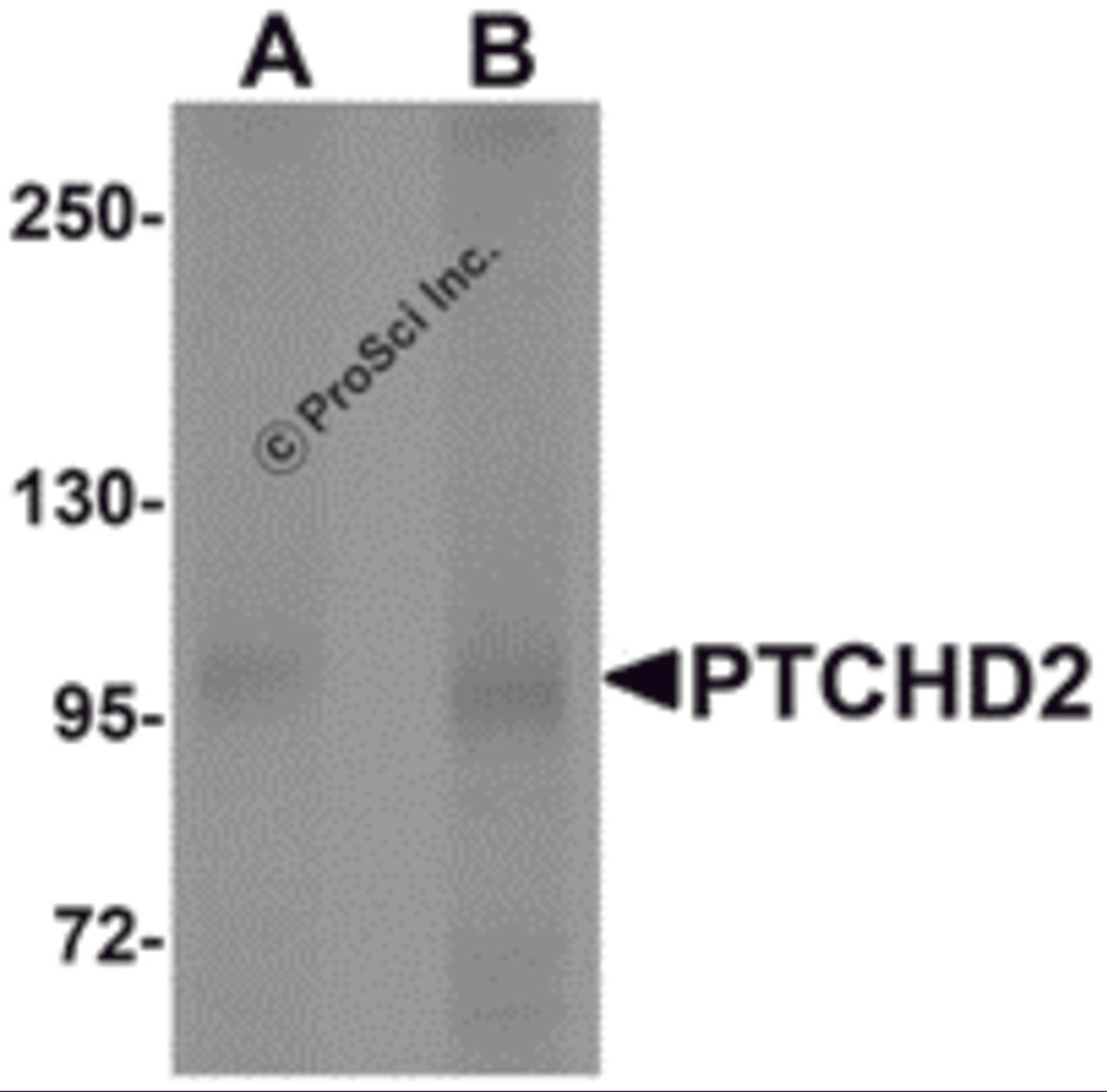 Western blot analysis of PTCHD2 in mouse kidney tissue lysate with PTCHD2 antibody at (A) 1 and (B) 2 μg/mL.