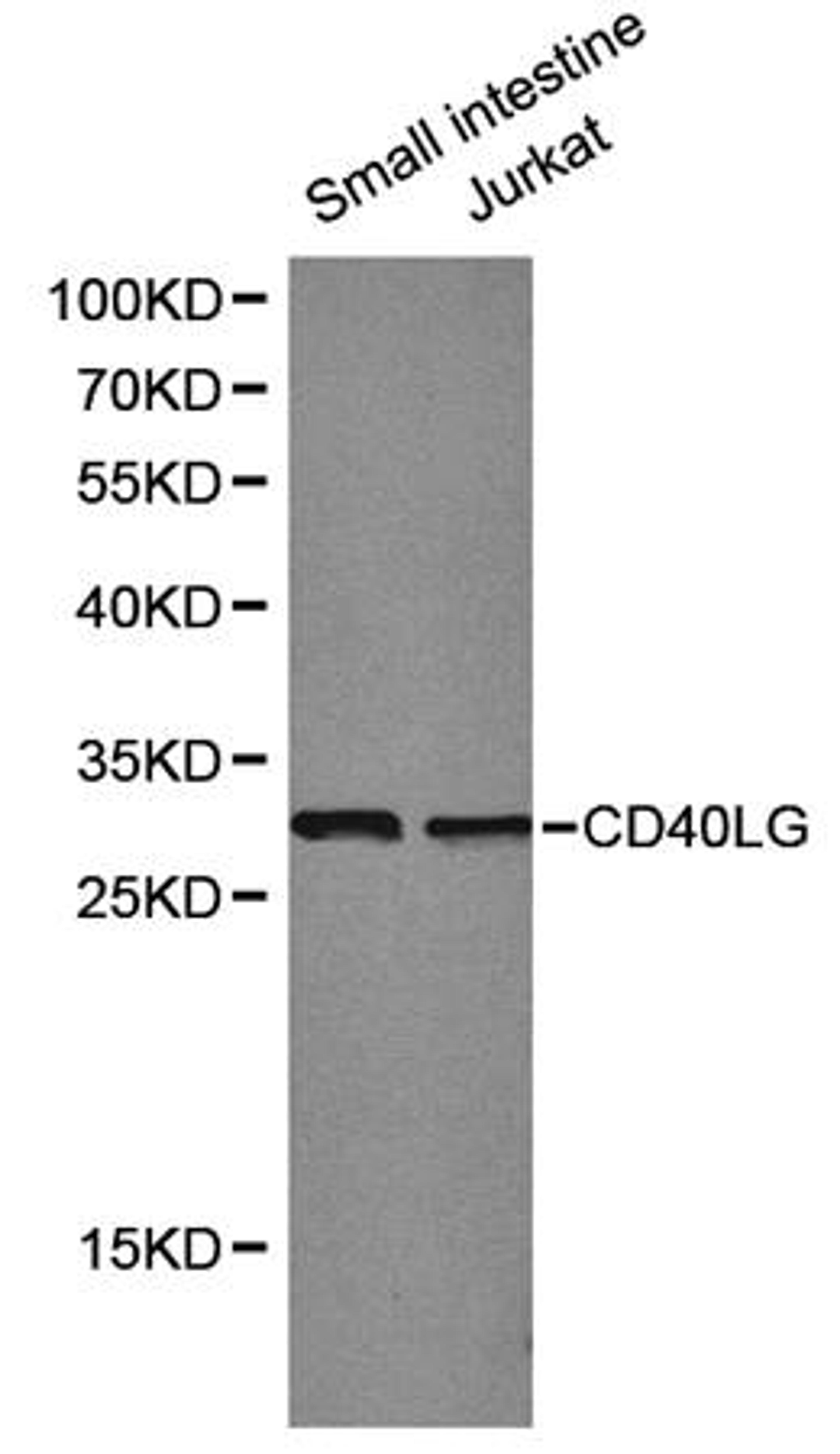 Western blot analysis of small intestine jurkat cell line lysates using CD40 Ligand antibody