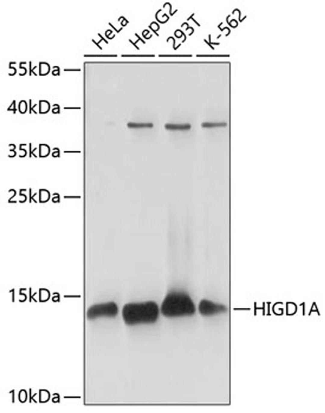 Western blot - HIGD1A antibody (A14582)