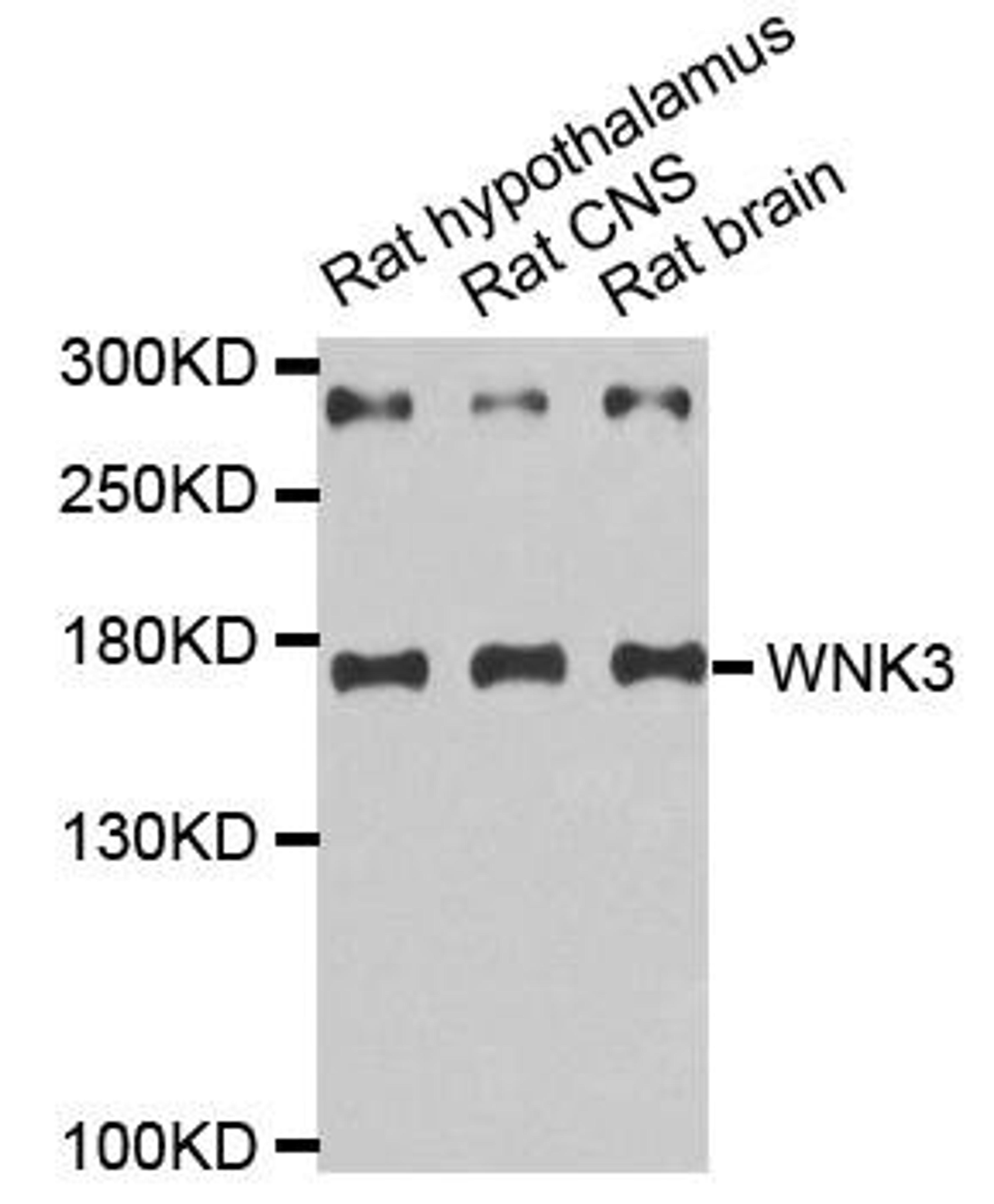 Western blot analysis of extracts of various tissues using WNK3 antibody