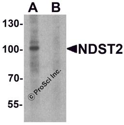 Western blot analysis of NDST2 in A-20 cell lysate with NDST2 antibody at 1 μg/ml in (A) the absence and (B) the presence of blocking peptide.