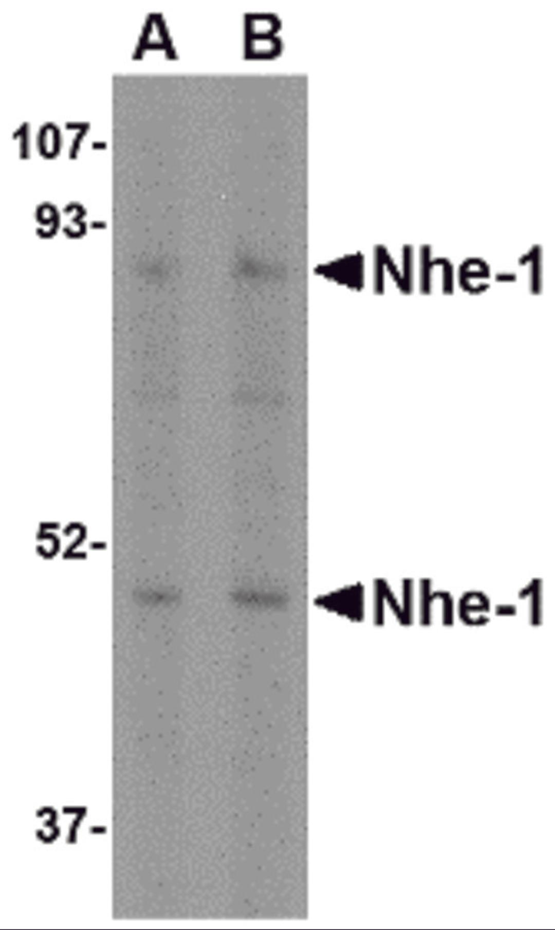 Western blot analysis of Nhe-1 in rat kidney tissue lysate with in with Nhe-1 antibody at (A) 1 and (B) 2 μg/mL.