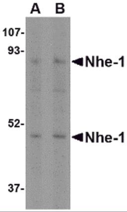 Western blot analysis of Nhe-1 in rat kidney tissue lysate with in with Nhe-1 antibody at (A) 1 and (B) 2 μg/mL.