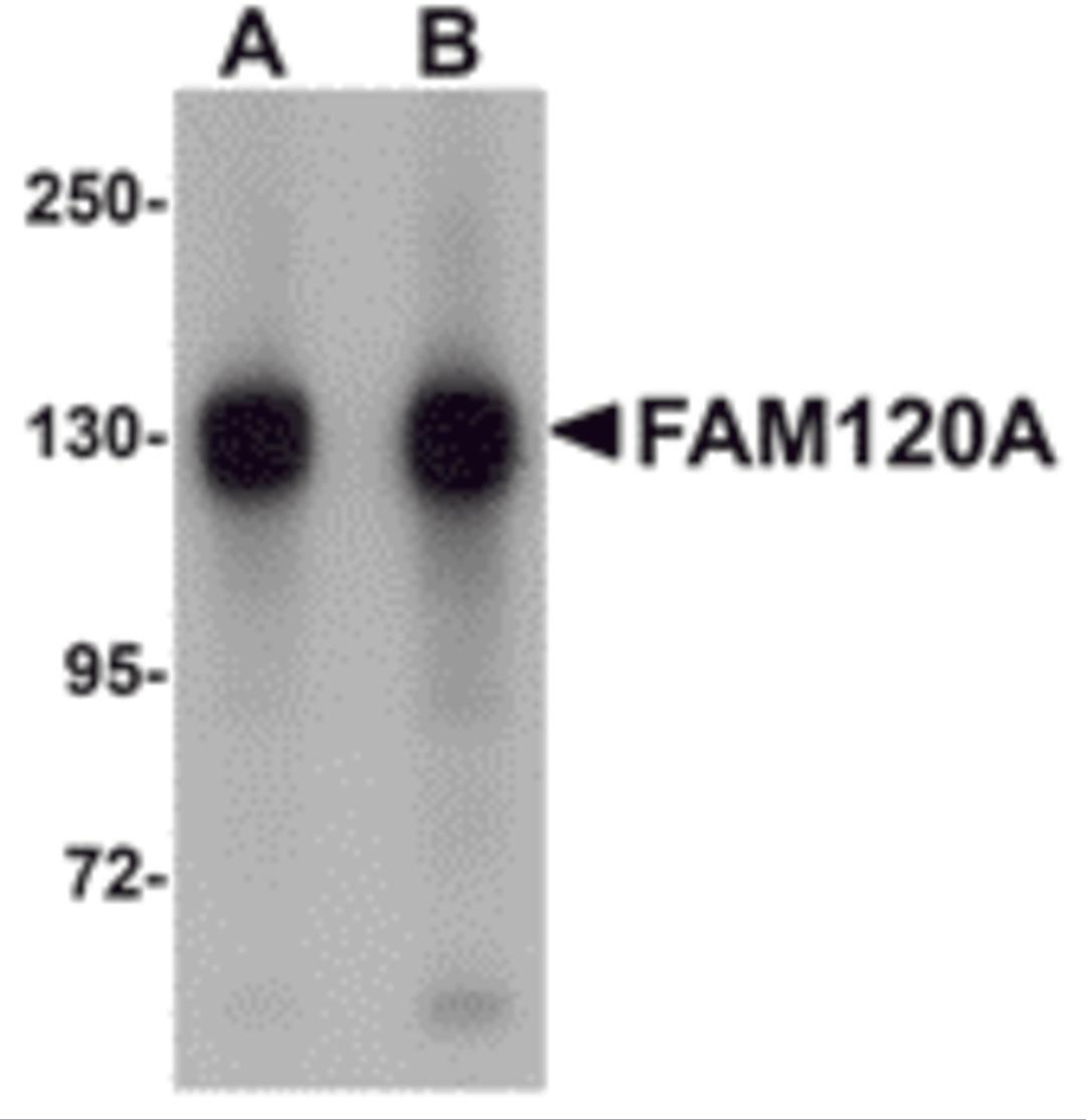 Western blot analysis of FAM120A in SK-N-SH cell lysate with FAM120A antibody at (A) 0.5 and (B) 1 &#956;g/mL.