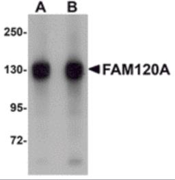 Western blot analysis of FAM120A in SK-N-SH cell lysate with FAM120A antibody at (A) 0.5 and (B) 1 &#956;g/mL.