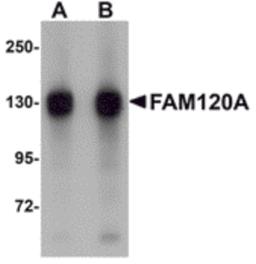 Western blot analysis of FAM120A in SK-N-SH cell lysate with FAM120A antibody at (A) 0.5 and (B) 1 μg/mL.