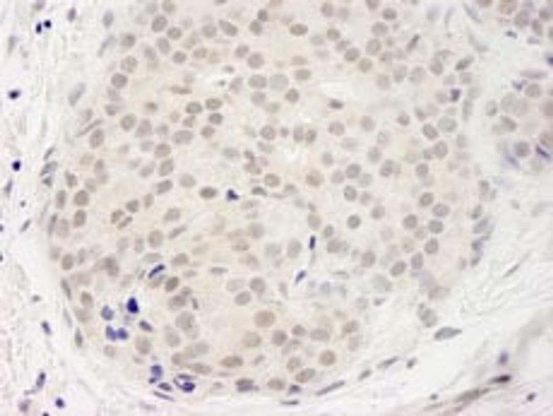 Detection of human DDX23 by immunohistochemistry.