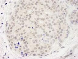 Detection of human DDX23 by immunohistochemistry.