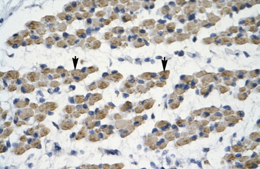 Antibody used in IHC on Human Muscle.