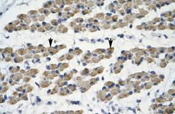 Antibody used in IHC on Human Muscle.