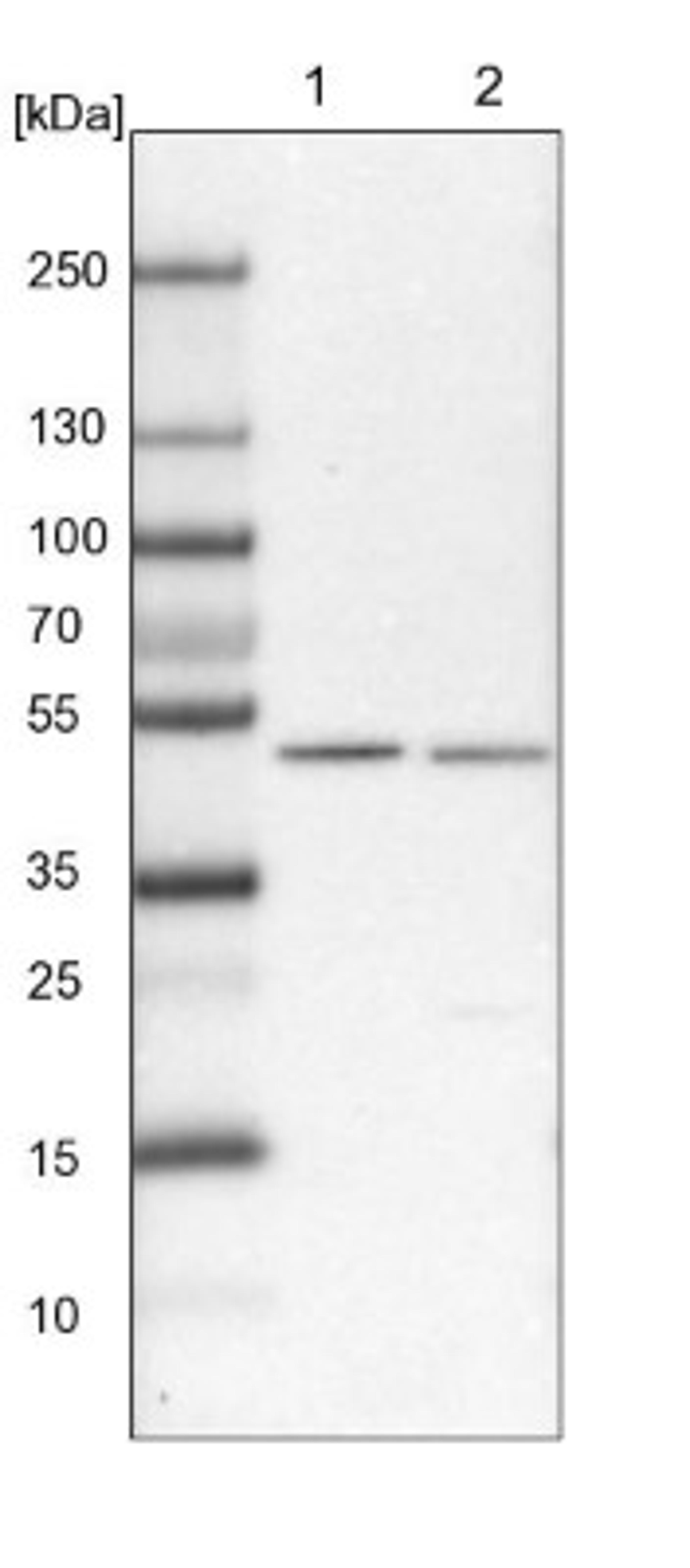 Western Blot: RENBP Antibody [NBP1-80851] - Lane 1: Mouse liver tissue lysate<br/>Lane 2: Rat liver tissue lysate