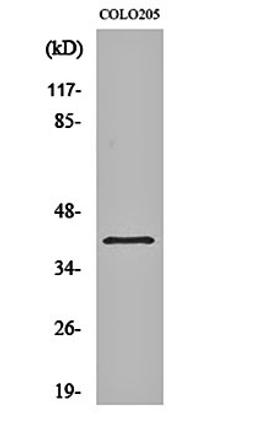 Western blot analysis of COLO205 cell lysates using GPR62 antibody