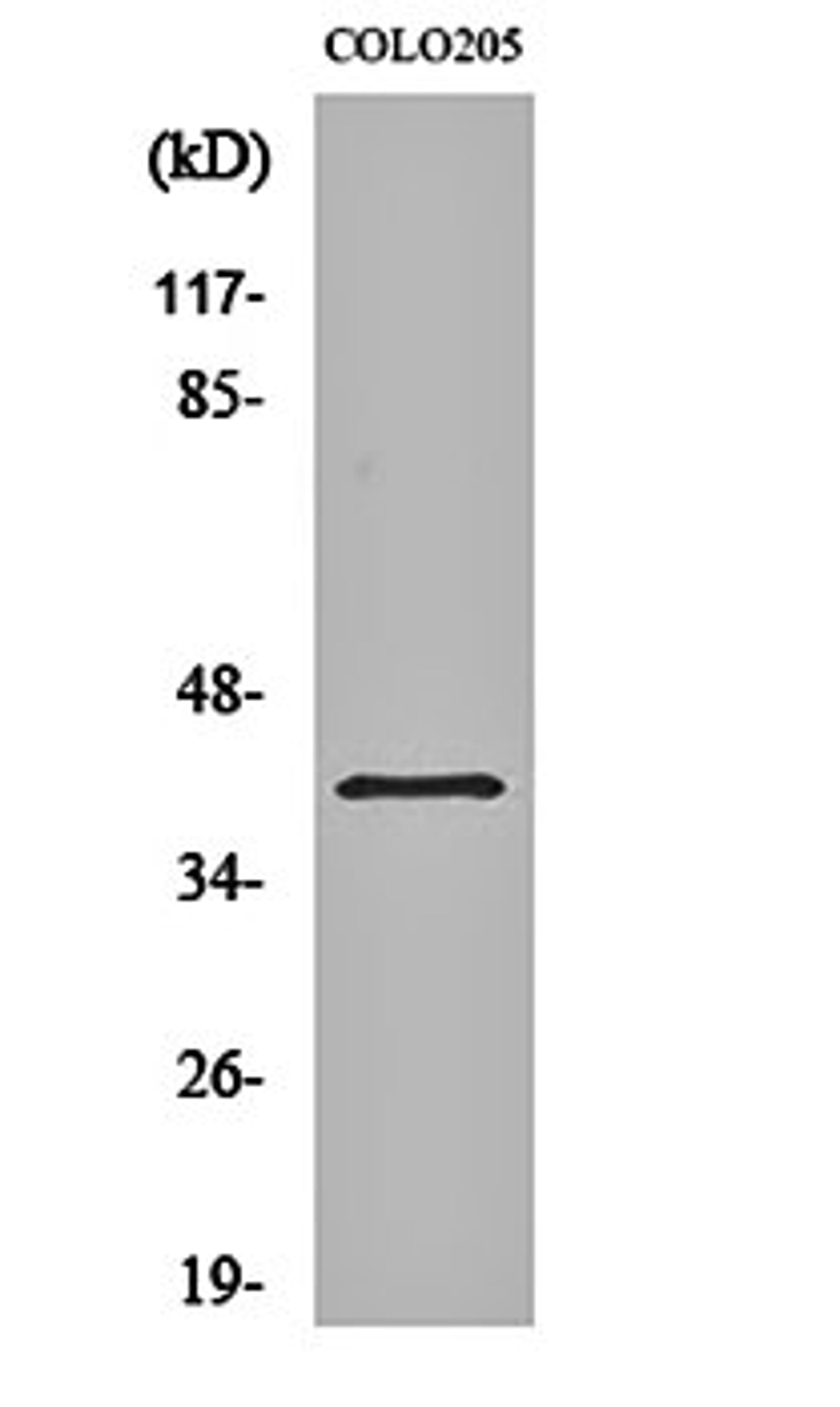 Western blot analysis of COLO205 cell lysates using GPR62 antibody