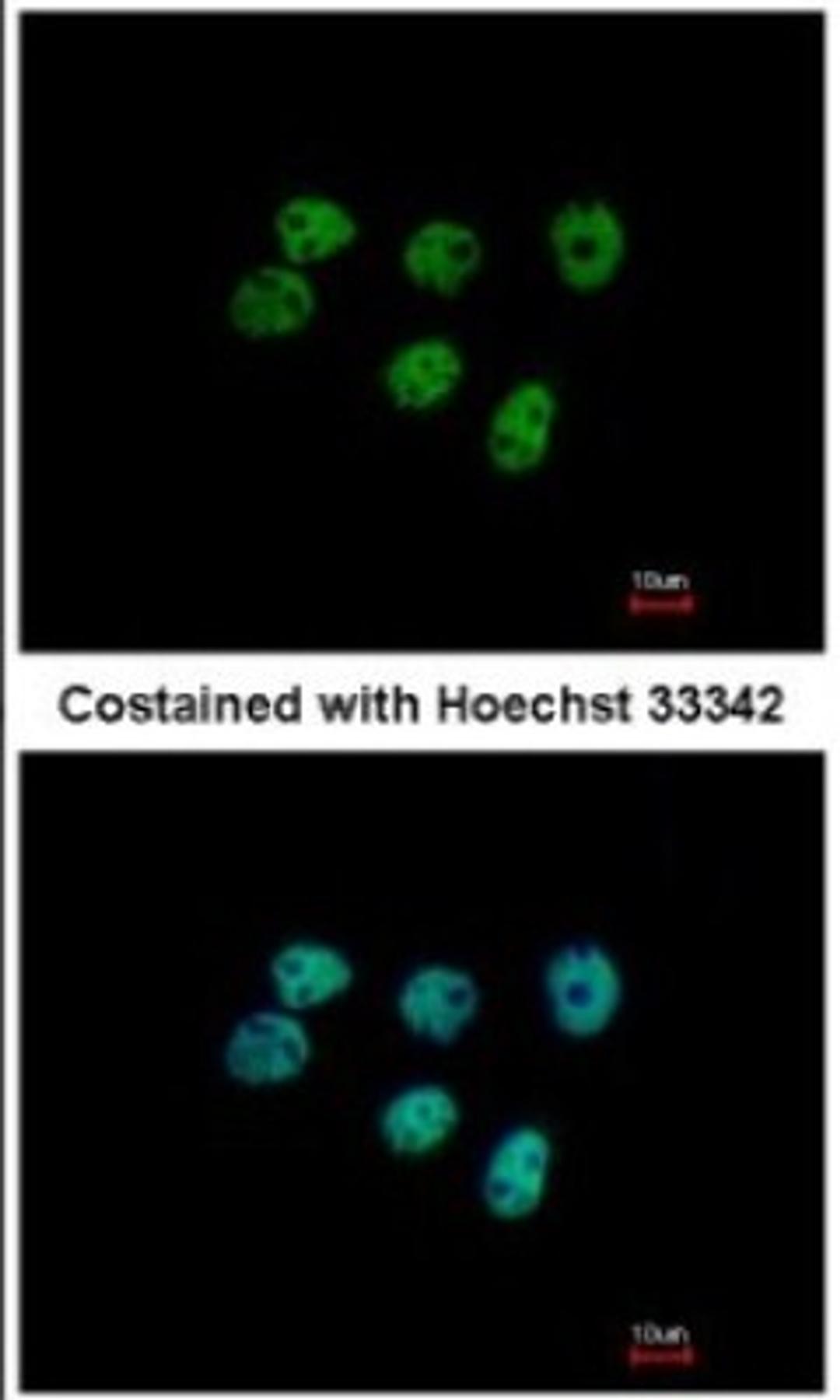 Immunocytochemistry/Immunofluorescence: ERM/Etv5 Antibody [NBP2-14950] - Paraformaldehyde-fixed A431, using antibody at 1:500 dilution.