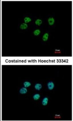 Immunocytochemistry/Immunofluorescence: ERM/Etv5 Antibody [NBP2-14950] - Paraformaldehyde-fixed A431, using antibody at 1:500 dilution.