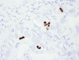 Detection of human Phospho Histone H3 (S10) by immunohistochemistry.