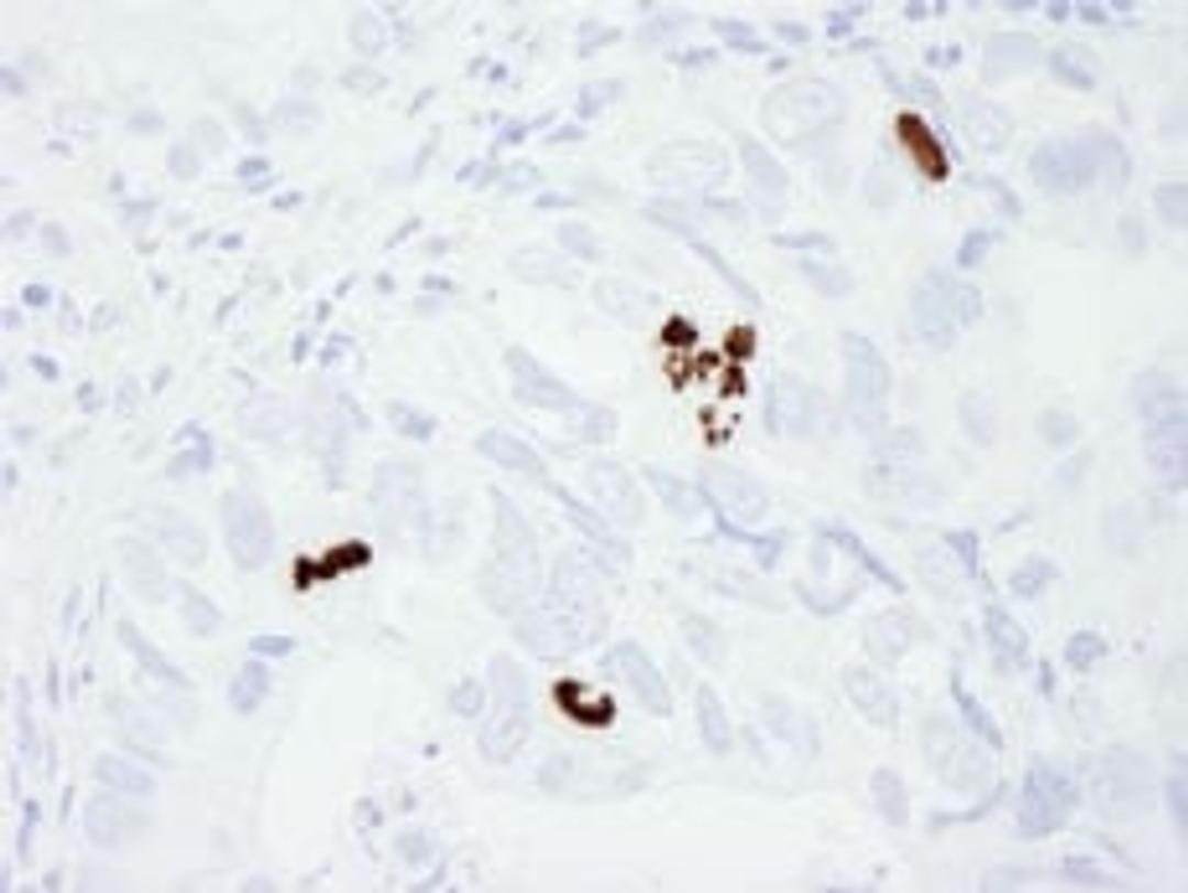 Detection of human Phospho Histone H3 (S10) by immunohistochemistry.