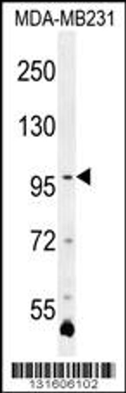Western blot analysis in MDA-MB231 cell line lysates (35ug/lane).