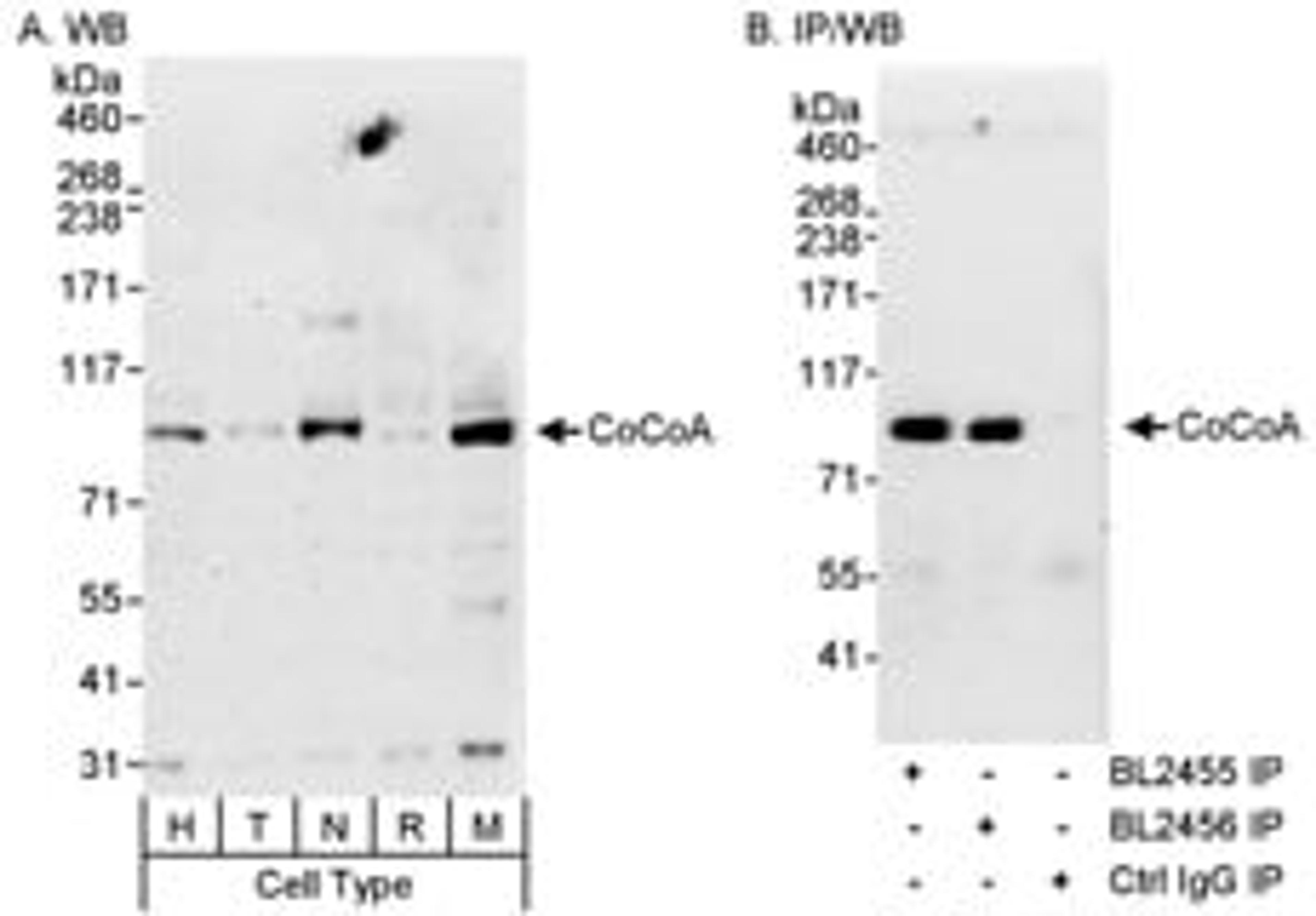 Detection of human and mouse CoCoA by western blot (h&m) and immunoprecipitation (h).