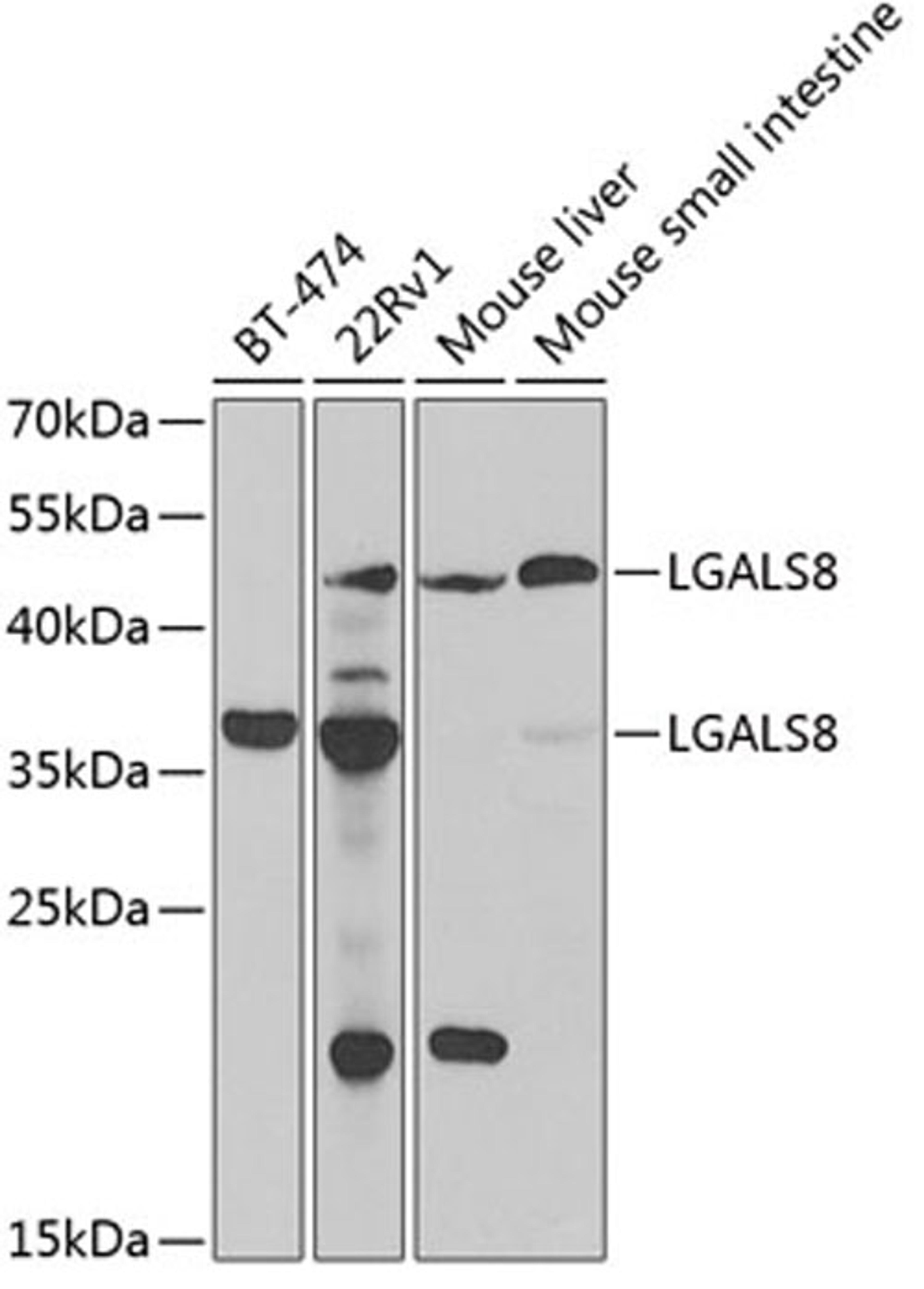 Western blot - LGALS8 antibody (A6646)