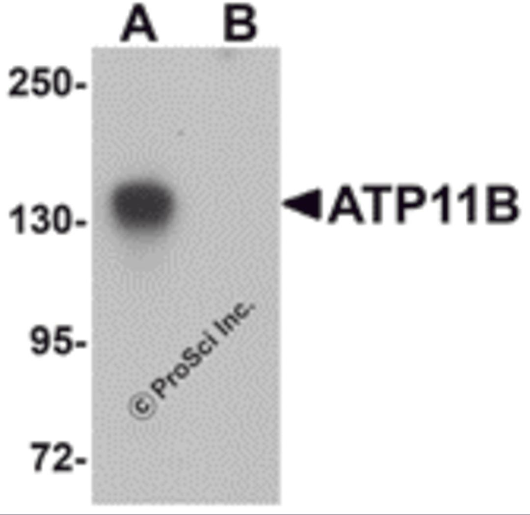 Western blot analysis of ATP11B in K562 cell tissue lysate with ATP11B antibody at 1 μg/mL in (A) the absence and (B) the presence of blocking peptide.